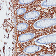 Vimentin antibody immunohistochemistry paraffin-embedded colon tissue STJA0037583