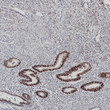 Estrogen Receptor alpha antibody immunohistochemistry endometrium STJA0037593