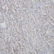 PAX2 antibody immunohistochemistry renal clear cell carcinoma STJA0037607