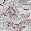 von Willebrand Factor antibody immunohistochemistry Hemangioma STJA0037637