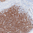 MelanA antibody immunohistochemistry malignant melanoma paraffin-embedded STJA0037639