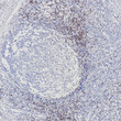 Immunohistochemistry paraffin Tonsil CD2 antibody Tris-EDTA pH 8 antigen retrieval STJA0037652