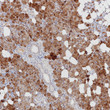 GCDFP 15 antibody immunohistochemistry salivary glands paraffin-embedded STJA0037661