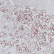 SDHB antibody immunohistochemistry kidney paraffin-embedded STJA0037685