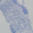 FOXP3 antibody immunohistochemistry colon cancer paraffin-embedded STJA0037691