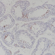 NUT antibody immunohistochemistry testis paraffin-embedded STJA0037718