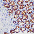 LI Cadherin antibody immunohistochemistry colon paraffin-embedded STJA0037747