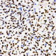 DiMethyl-Histone H3-K4 antibody immunohistochemistry human kidney cancer STJA0037752