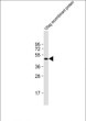 HIS Tag antibody western blot recombinant protein STJS001238
