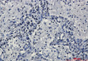 TriMethyl-Histone H3 Lys27 antibody immunohistochemistry human lung cancer STJA0035048