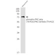 Phospho-PKC zeta/lambda antibody western blot mouse brain STJA0035087
