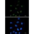CTBP1 antibody immunocytochemistry HepG2 STJA0035168