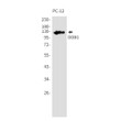 DDB1 antibody western blot PC-12 cells STJA0035179