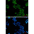 GC1q R antibody immunocytochemistry HeLa cells STJA0035206