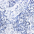 Histone H2AX antibody immunohistochemistry human lung cancer STJA0035222
