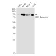 IGF1 Receptor antibody western blot HeLa A549 MCF-7 U251 STJA0035232