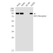 IGF1 Receptor antibody western blot HeLa A549 HL-60 U2OS STJA0035233