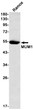MUM1 antibody western blot Ramos STJA0035279