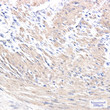 muscle Actin antibody immunohistochemistry human colon cancer STJA0035281