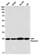 RhoGDI antibody western blot HeLa A549 HL-60 C6 STJA0035351