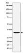 Hepcidin antibody western blot human recombinant protein GFP tagged STJA0035458