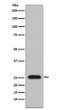 Lambda Light chain antibody western blot human plasma STJA0035471