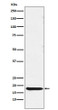 TSH beta antibody western blot human pituitary STJA0035485