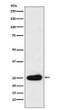 Kappa light chain antibody western blot human plasma STJA0035512