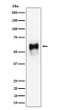 CD58 antibody western blot Raji lysates STJA0035522