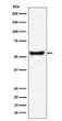 PDCD7 antibody western blot Jurkat cells STJA0035544
