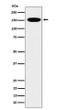 NCAPD2 antibody western blot HeLa cells STJA0035575
