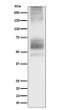 Somatostatin Receptor 1 antibody western blot 293T STJA0035580