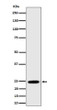 RalA antibody western blot MCF7 lysates STJA0035610