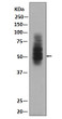 GLUT1 antibody western blot HepG2 lysates STJA0035715