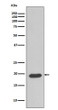 Caveolin 3 antibody western blot human fetal heart STJA0035736