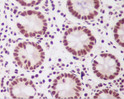 PTBP2 antibody immunohistochemistry human colon STJA0035765