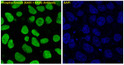 Phospho-Smad3 antibody immunofluorescence A549 TGFBeta STJA0035799