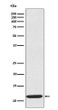 CCL19 beta antibody western blot recombinant protein STJA0035801