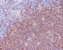 CD20 antibody immunohistochemistry human tonsil STJA0035807