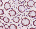 Phospho-DNA PKcs antibody immunohistochemistry human colon STJA0035811
