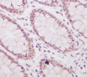 Histone H3 acetyl K56 antibody immunohistochemistry human colon STJA0035815