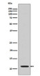 Acetyl-Histone H4 antibody western blot HeLa TSA-treated STJA0035861