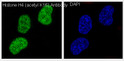 Acetyl-Histone H4 antibody immunofluorescence HeLa TSA STJA0035861