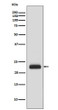 RAIDD antibody western blot HeLa lysates STJA0035865