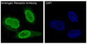 Androgen Receptor antibody immunofluorescence MCF-7 STJA0035884