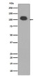 PSD95 antibody western blot mouse brain lysate STJA0035916