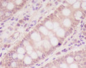 M6PR antibody immunohistochemistry human colon STJA0035945