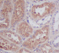 Apolipoprotein E antibody immunohistochemistry human kidney STJA0035968