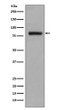 GOLPH2 antibody western blot LnCaP lysates STJA0035973