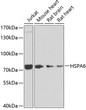 Western blot analysis of extracts of various cell lines, using HSPA6 antibody (STJ110001) at 1:1000 dilution. Secondary antibody: HRP Goat Anti-Rabbit IgG (H+L) (STJS000856) at 1:10000 dilution. Lysates/proteins: 25 Mu g per lane. Blocking buffer: 3% nonfat dry milk in TBST. Detection: ECL Basic Kit. Exposure time: 30s.